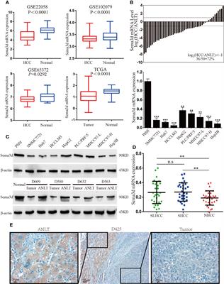 Sema3d Restrained Hepatocellular Carcinoma Progression Through Inactivating Pi3k/Akt Signaling via Interaction With FLNA